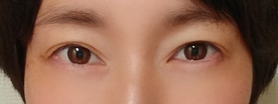 アイプチ後の写真