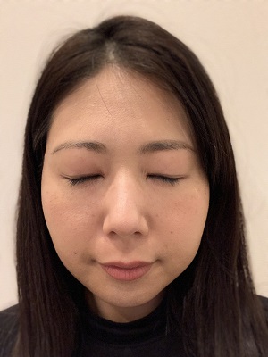 アイプチをした目元の写真