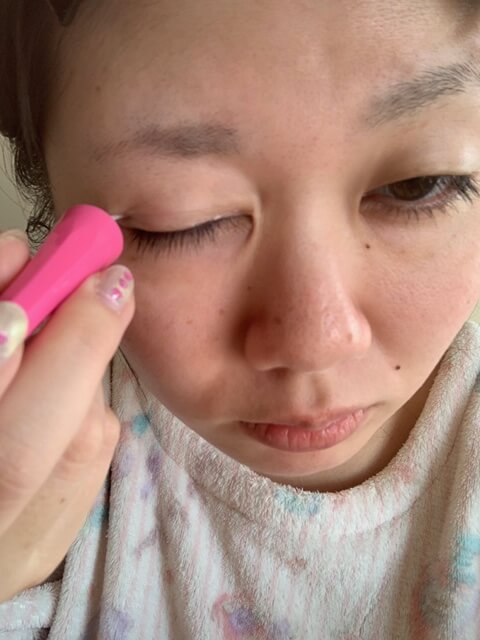 アイプチを縫っている写真